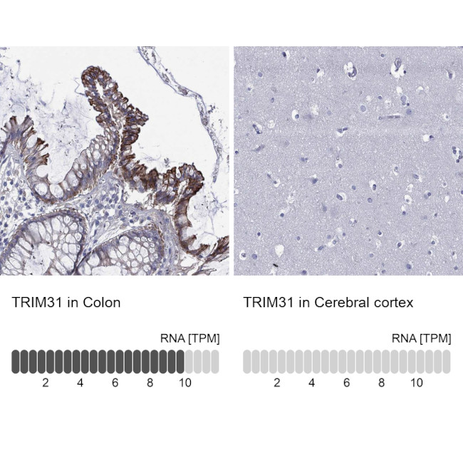 TRIM31 Antibody in Immunohistochemistry (Paraffin) (IHC (P))
