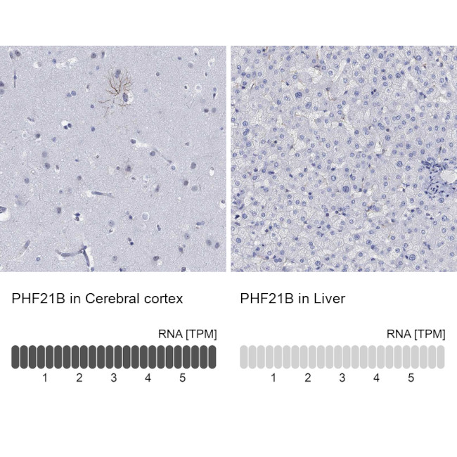 PHF21B Antibody in Immunohistochemistry (Paraffin) (IHC (P))