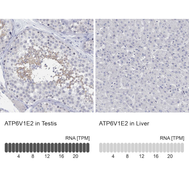 V-ATPase E2 Antibody in Immunohistochemistry (Paraffin) (IHC (P))