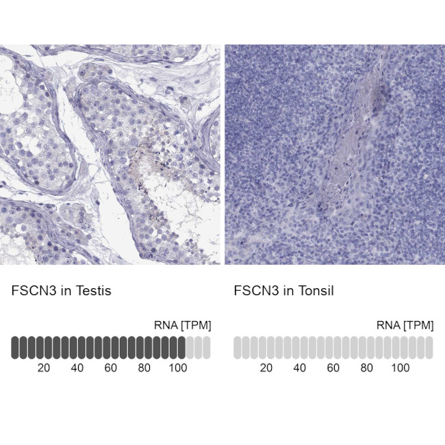 Fascin-3 Antibody in Immunohistochemistry (Paraffin) (IHC (P))