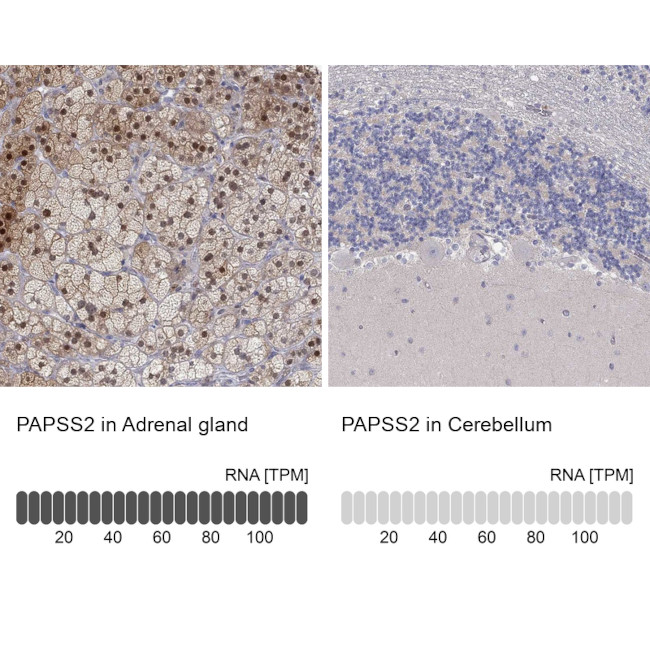 PAPSS2 Antibody in Immunohistochemistry (Paraffin) (IHC (P))