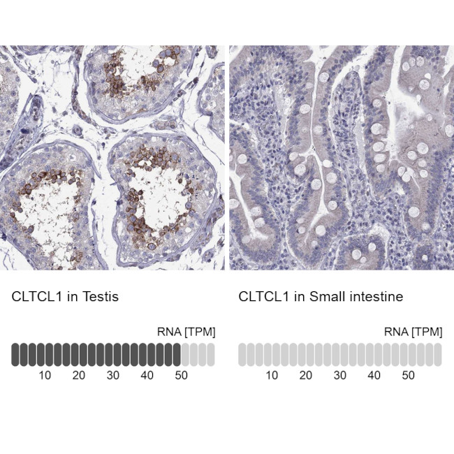 CLTCL1 Antibody in Immunohistochemistry (Paraffin) (IHC (P))