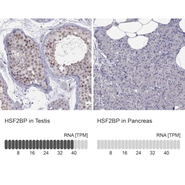 HSF2BP Antibody in Immunohistochemistry (Paraffin) (IHC (P))