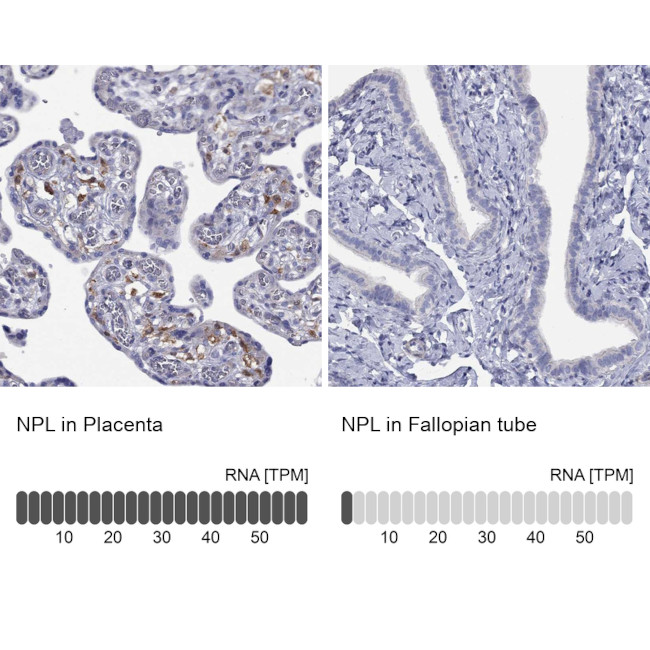 NPL Antibody in Immunohistochemistry (Paraffin) (IHC (P))