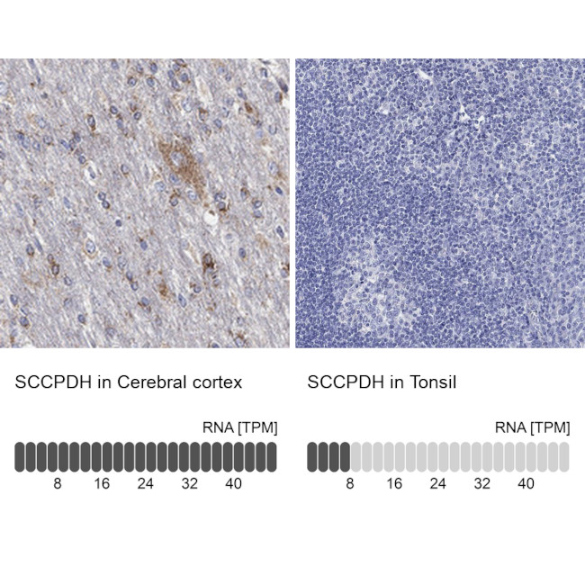 SCCPDH Antibody in Immunohistochemistry (Paraffin) (IHC (P))