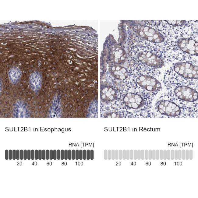 SULT2B1 Antibody in Immunohistochemistry (Paraffin) (IHC (P))