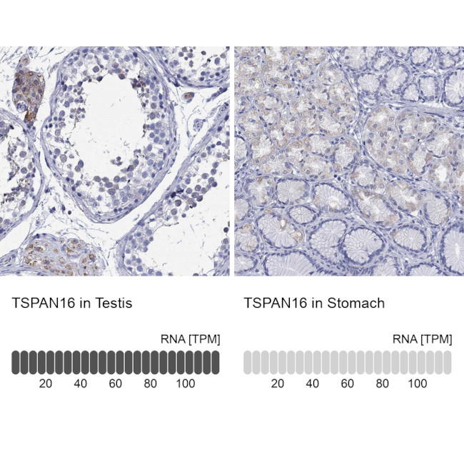 TSPAN16 Antibody in Immunohistochemistry (Paraffin) (IHC (P))
