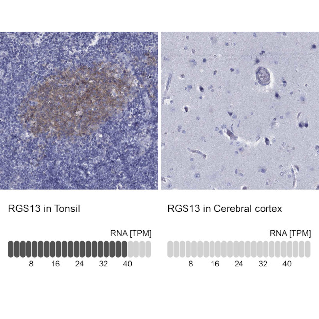 RGS13 Antibody in Immunohistochemistry (Paraffin) (IHC (P))
