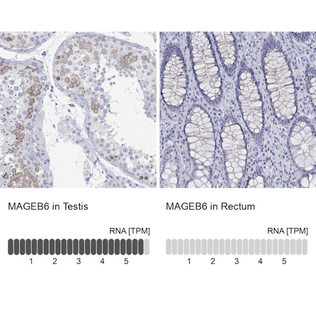 MAGEB6 Antibody in Immunohistochemistry (Paraffin) (IHC (P))