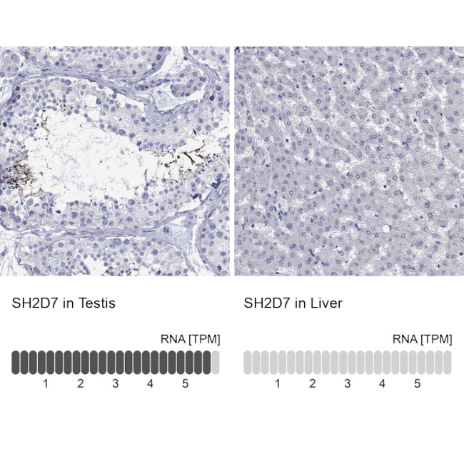 SH2D7 Antibody in Immunohistochemistry (Paraffin) (IHC (P))