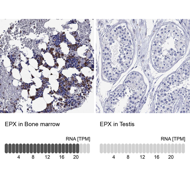 EPX Antibody in Immunohistochemistry (Paraffin) (IHC (P))