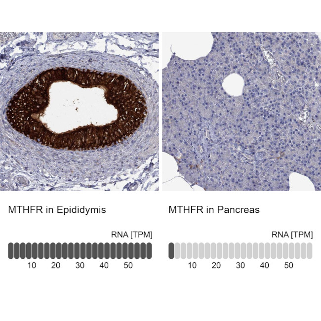 MTHFR Antibody in Immunohistochemistry (Paraffin) (IHC (P))