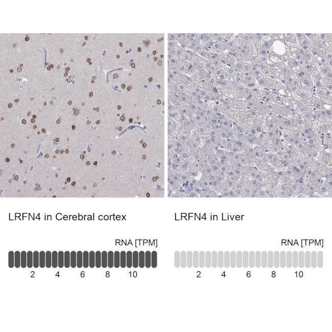 LRFN4 Antibody in Immunohistochemistry (Paraffin) (IHC (P))