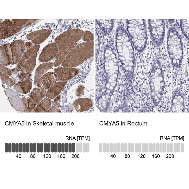 CMYA5 Antibody in Immunohistochemistry (Paraffin) (IHC (P))