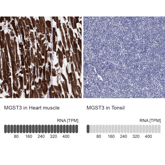 MGST3 Antibody in Immunohistochemistry (Paraffin) (IHC (P))
