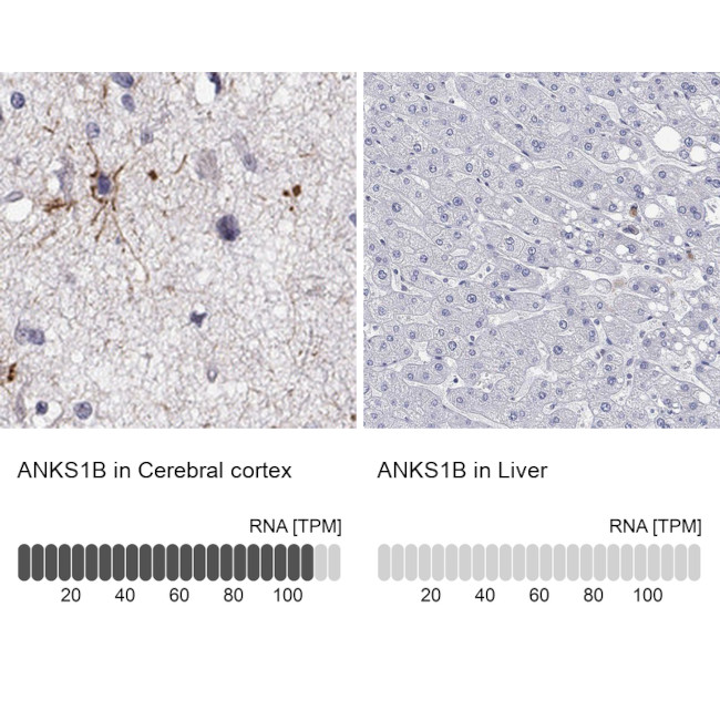 ANKS1B Antibody in Immunohistochemistry (Paraffin) (IHC (P))