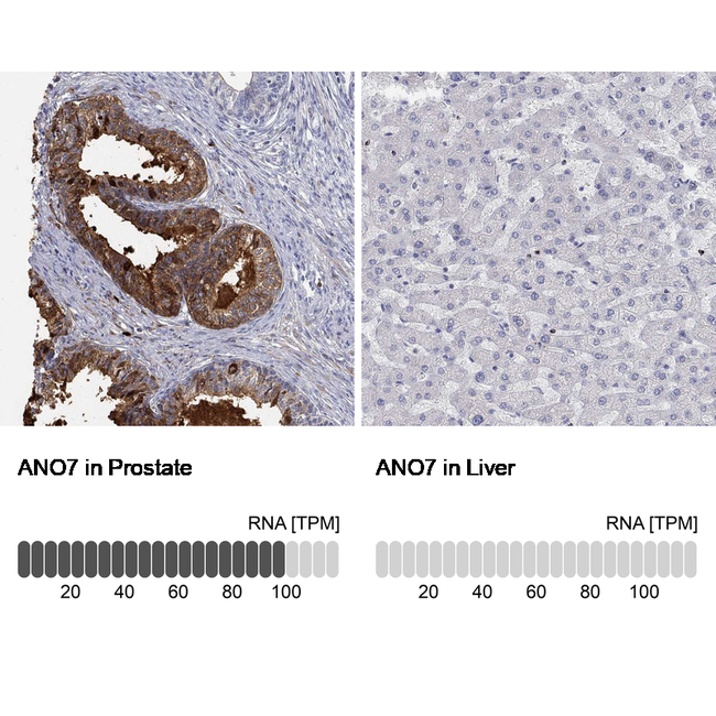 ANO7 Antibody in Immunohistochemistry (Paraffin) (IHC (P))