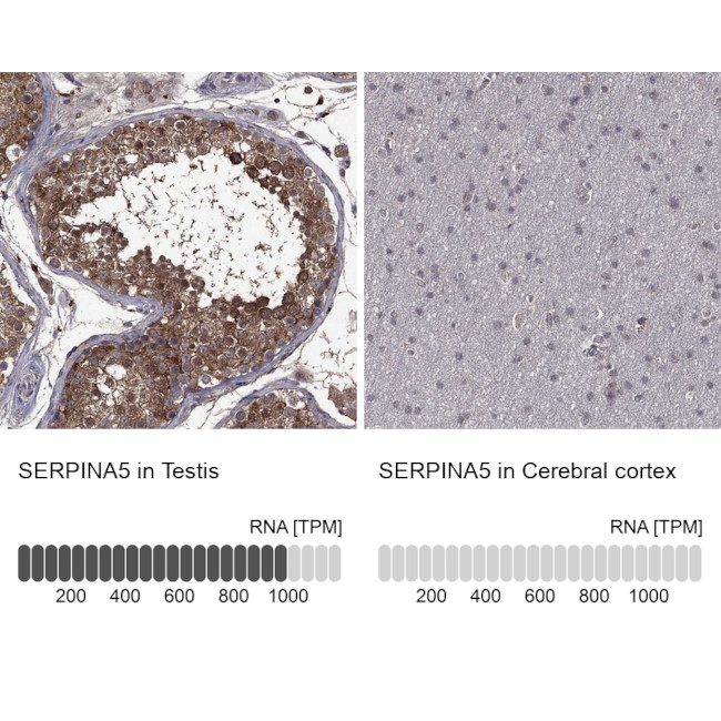 SERPINA5 Antibody in Immunohistochemistry (Paraffin) (IHC (P))