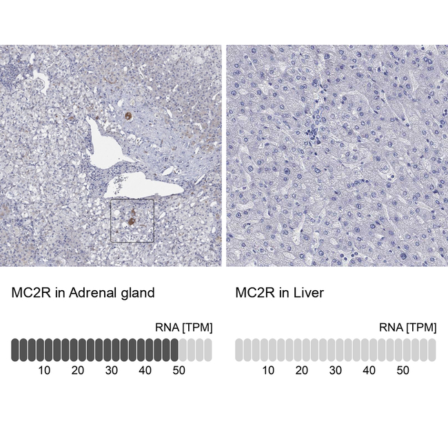 MC2R Antibody in Immunohistochemistry (Paraffin) (IHC (P))