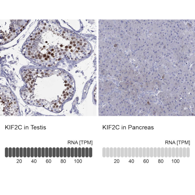 MCAK Antibody in Immunohistochemistry (Paraffin) (IHC (P))