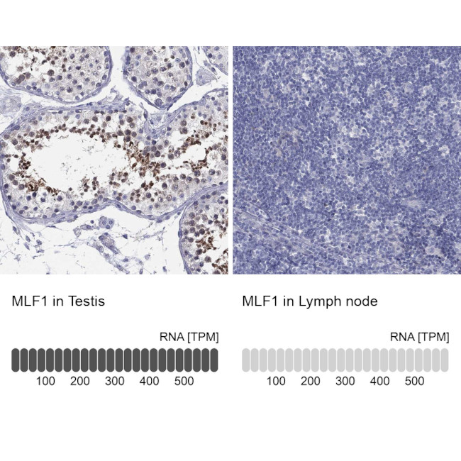 MLF1 Antibody in Immunohistochemistry (Paraffin) (IHC (P))