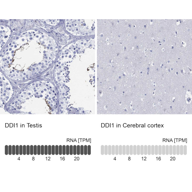DDI1 Antibody in Immunohistochemistry (Paraffin) (IHC (P))