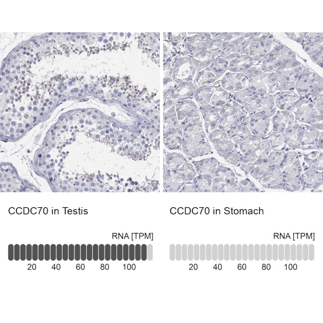 CCDC70 Antibody in Immunohistochemistry (Paraffin) (IHC (P))