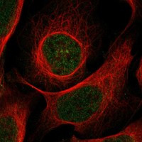 BTBD11 Antibody in Immunocytochemistry (ICC/IF)