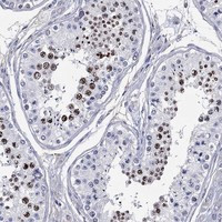 CDY2B Antibody in Immunohistochemistry (Paraffin) (IHC (P))