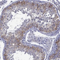 EPPIN-WFDC6 Antibody in Immunohistochemistry (Paraffin) (IHC (P))
