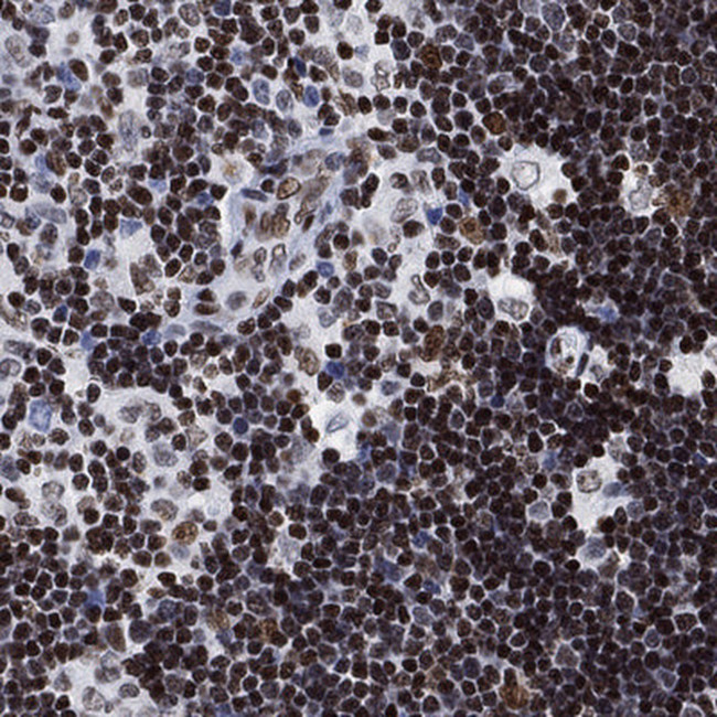 H1FX Antibody in Immunohistochemistry (Paraffin) (IHC (P))