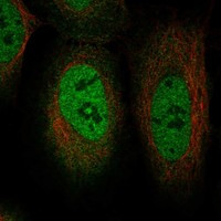 TRIM49D1 Antibody in Immunocytochemistry (ICC/IF)