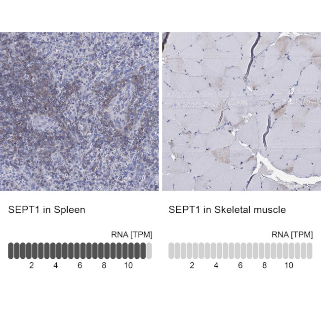 Septin 1 Antibody in Immunohistochemistry (Paraffin) (IHC (P))
