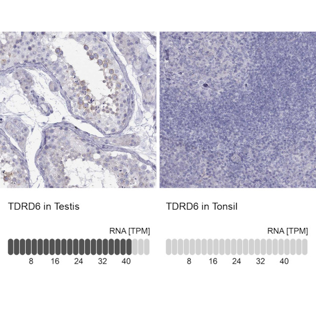 TDRD6 Antibody in Immunohistochemistry (Paraffin) (IHC (P))