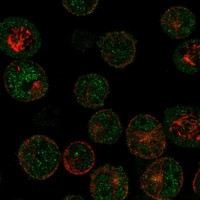 MAGEB16 Antibody in Immunocytochemistry (ICC/IF)