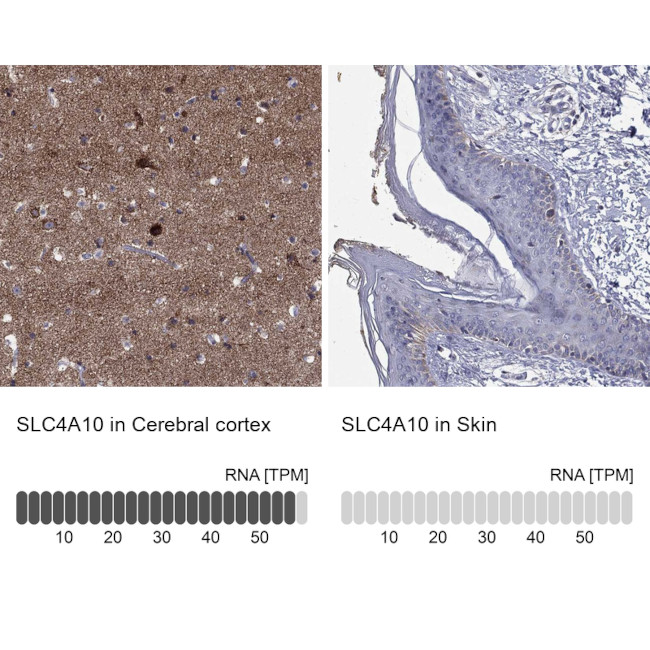 SLC4A10 Antibody in Immunohistochemistry (Paraffin) (IHC (P))
