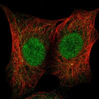 ZNF206 Antibody in Immunocytochemistry (ICC/IF)
