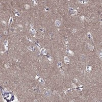 LY6H Antibody in Immunohistochemistry (Paraffin) (IHC (P))