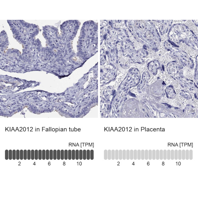 KIAA2012 Antibody in Immunohistochemistry (Paraffin) (IHC (P))