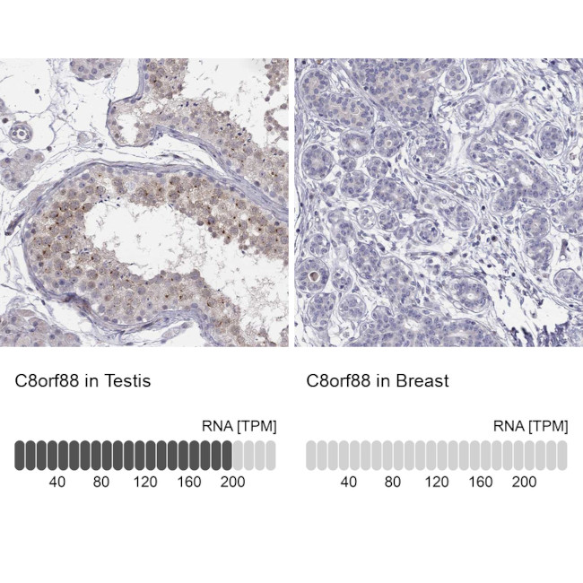 C8orf88 Antibody in Immunohistochemistry (Paraffin) (IHC (P))