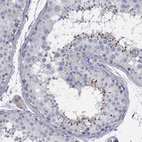 TMEM249 Antibody in Immunohistochemistry (Paraffin) (IHC (P))