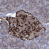 SELENOO Antibody in Immunohistochemistry (Paraffin) (IHC (P))