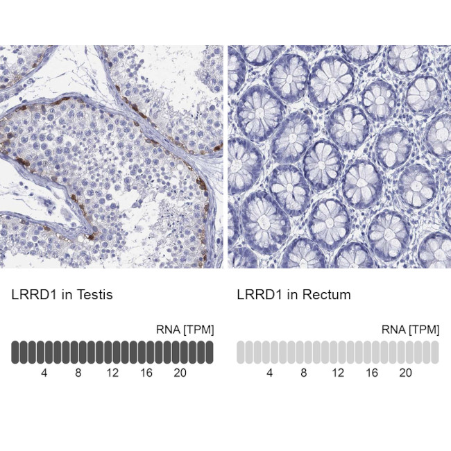 LRRD1 Antibody in Immunohistochemistry (Paraffin) (IHC (P))