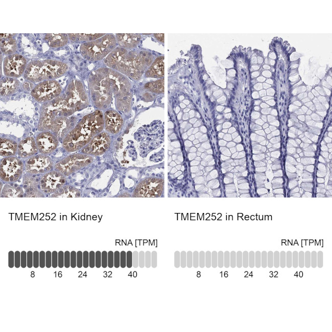 TMEM252 Antibody in Immunohistochemistry (Paraffin) (IHC (P))