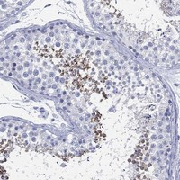 TMEM247 Antibody in Immunohistochemistry (Paraffin) (IHC (P))