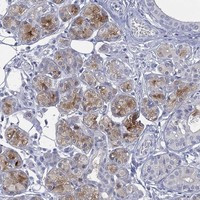 C5orf46 Antibody in Immunohistochemistry (Paraffin) (IHC (P))
