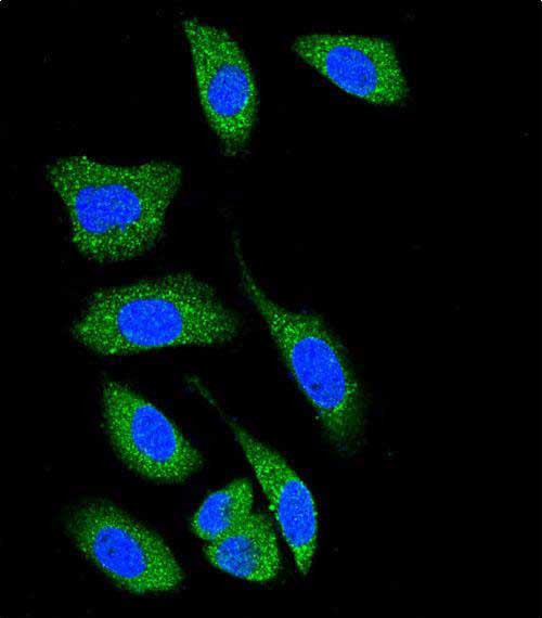 DAPK1 Antibody in Immunocytochemistry (ICC/IF)