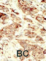 STK35 Antibody in Immunohistochemistry (Paraffin) (IHC (P))