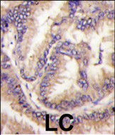 CDKL5 Antibody in Immunohistochemistry (Paraffin) (IHC (P))