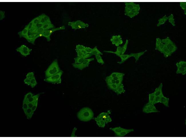 NSE Antibody in Immunocytochemistry (ICC/IF)